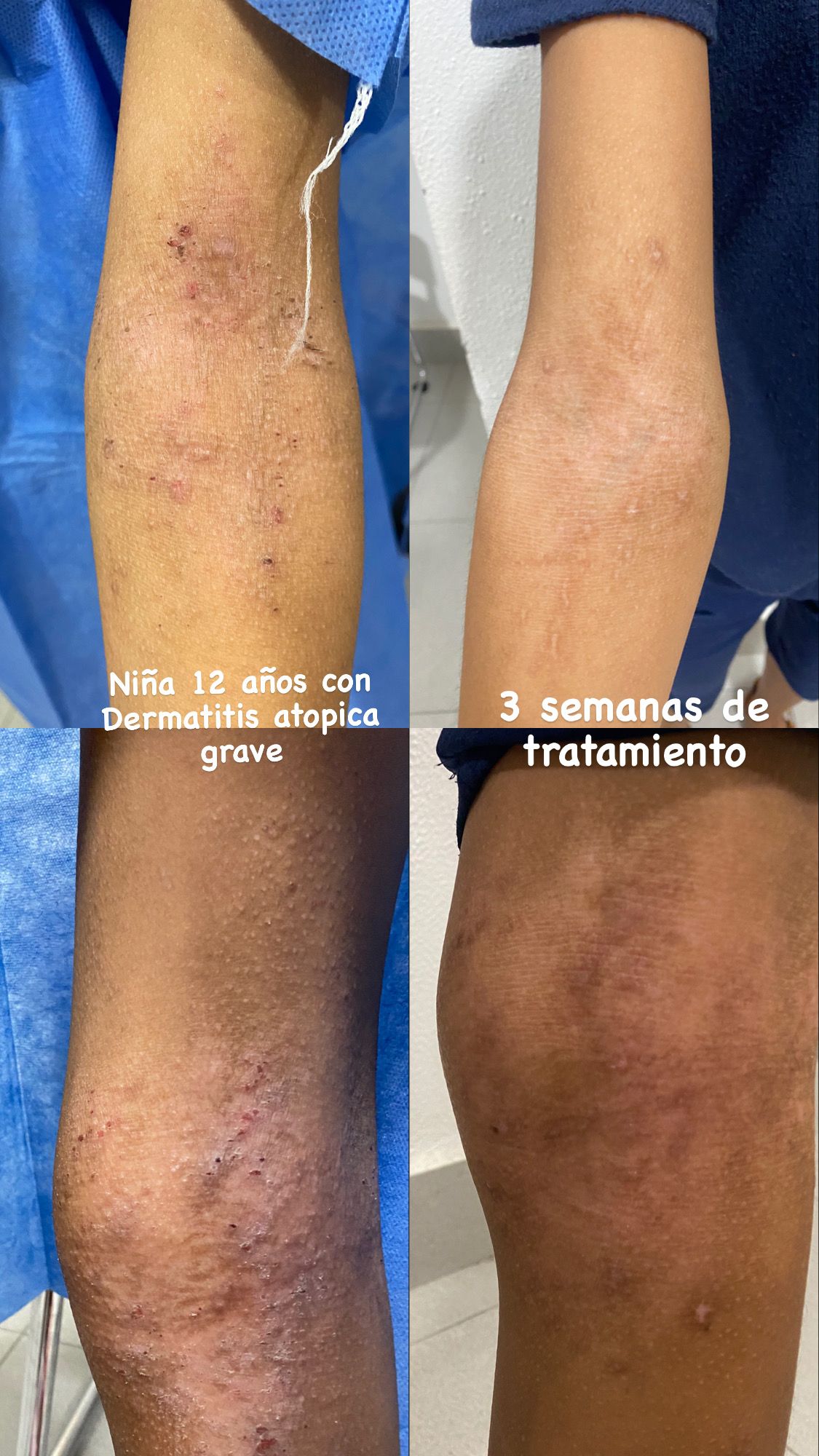 Elena Yaressy Terrones-1