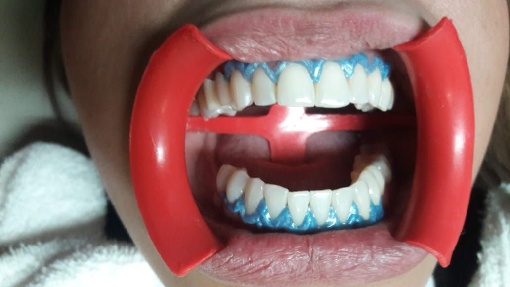 Alberto Rodríguez Soto-23