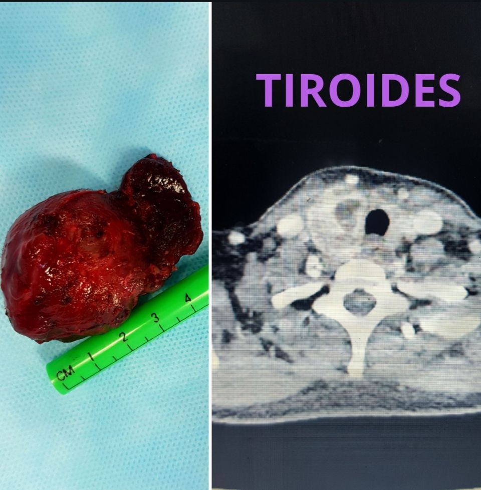 Damaris Yamel Neri Torres-4