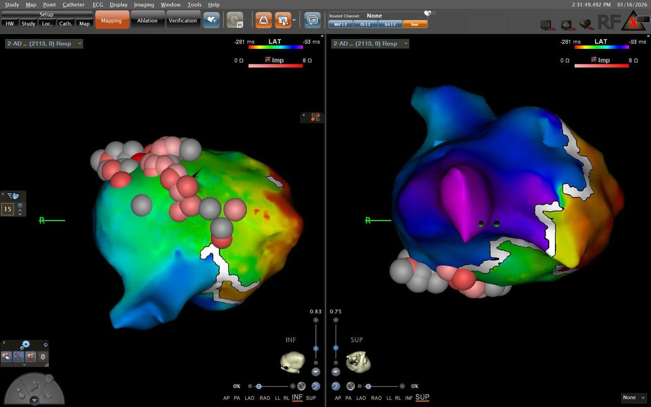Elias Andrade Cuellar-11