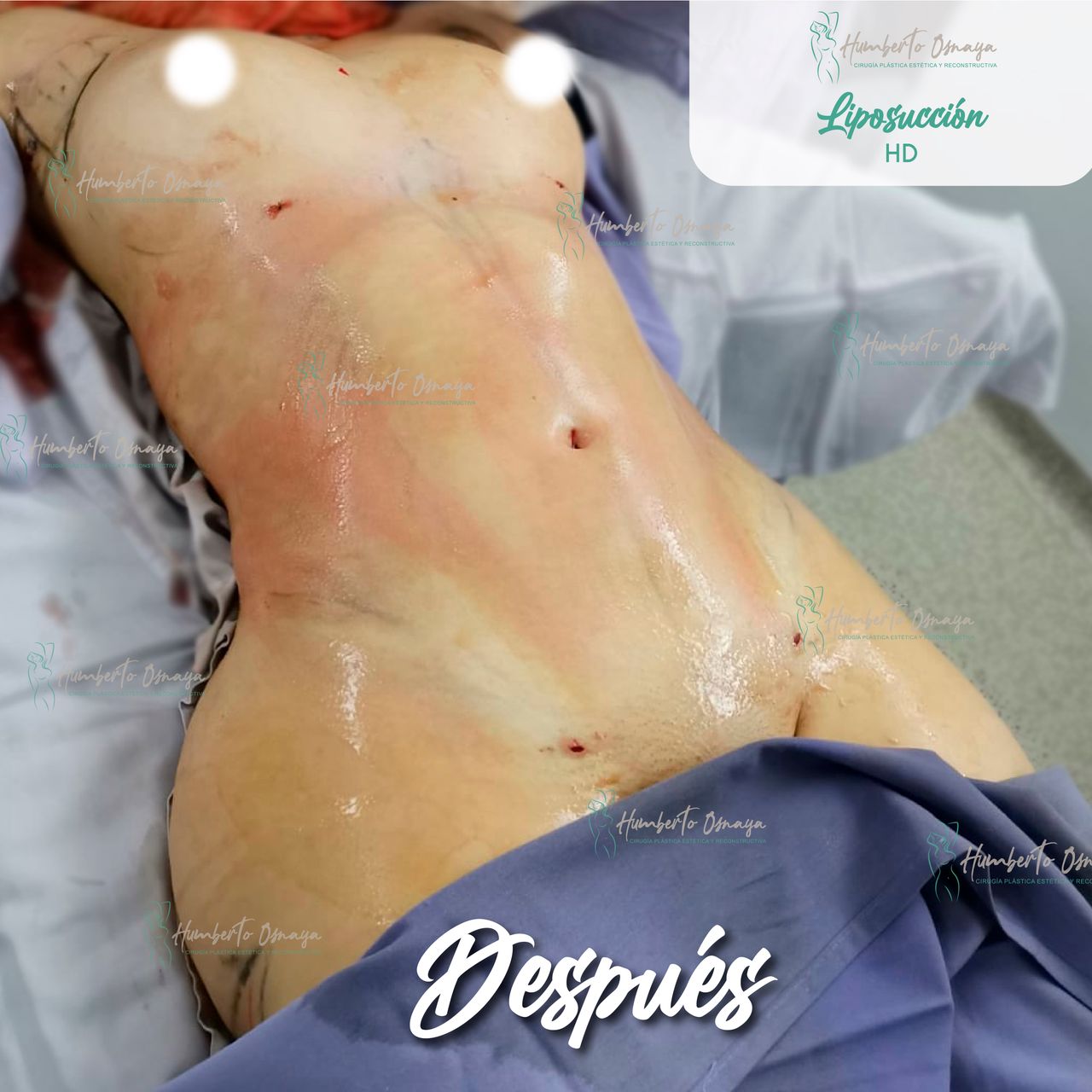 Humberto Osnaya Moreno-20