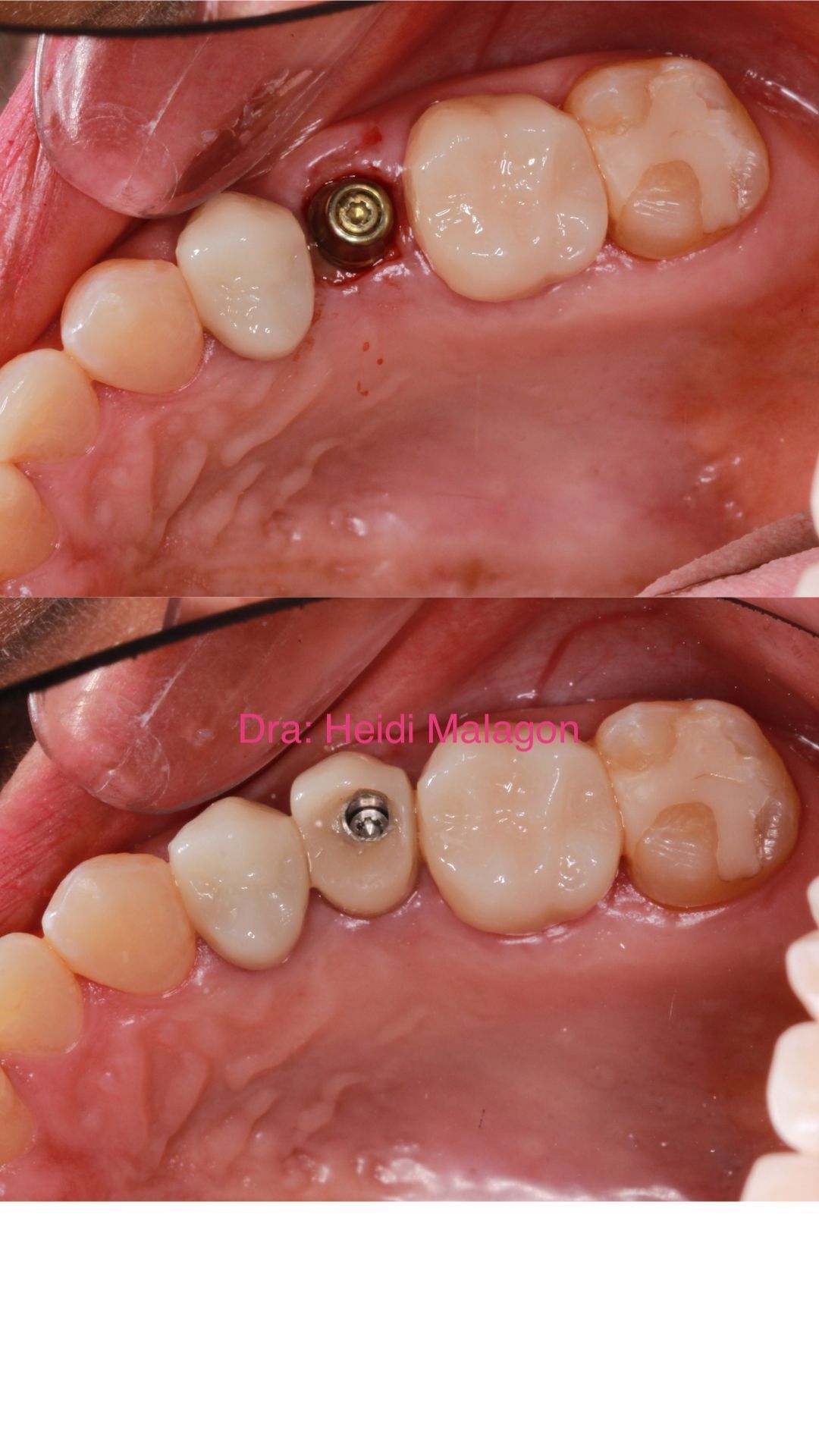 Heidi Mendoza Malagón-18