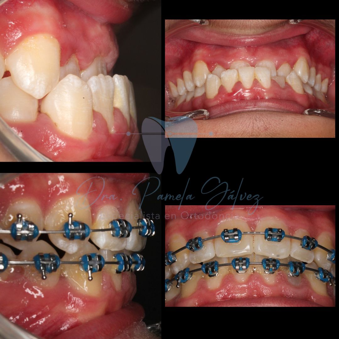 Pamela Alejandra Galvez Almeda-4