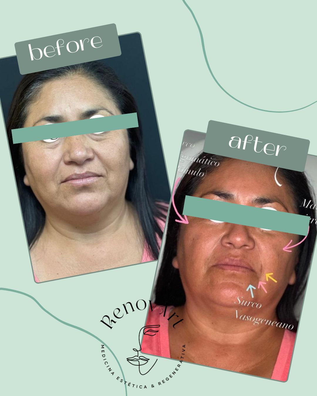 Mayre Anayeli Chávez Gutiérrez-0