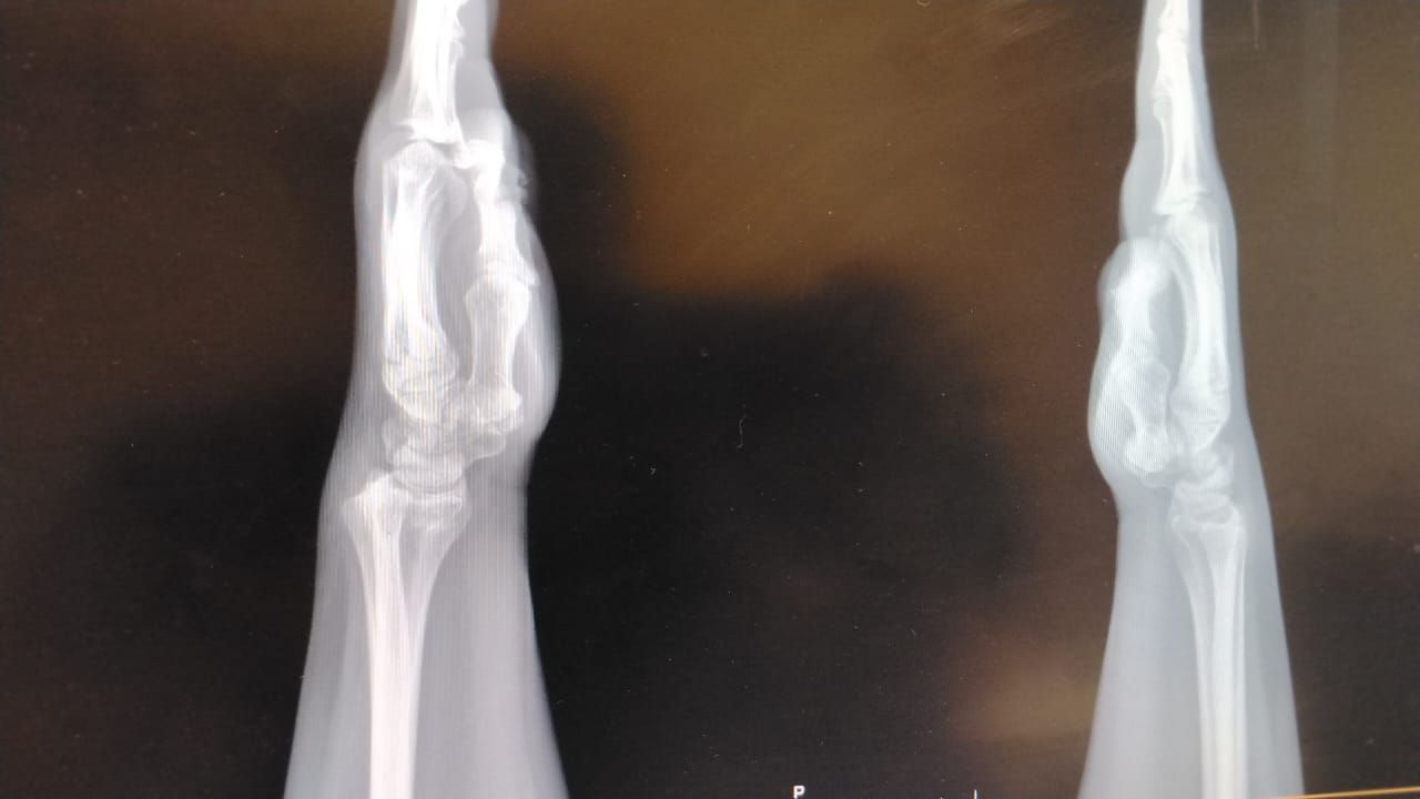 Alejandro Irisson-29