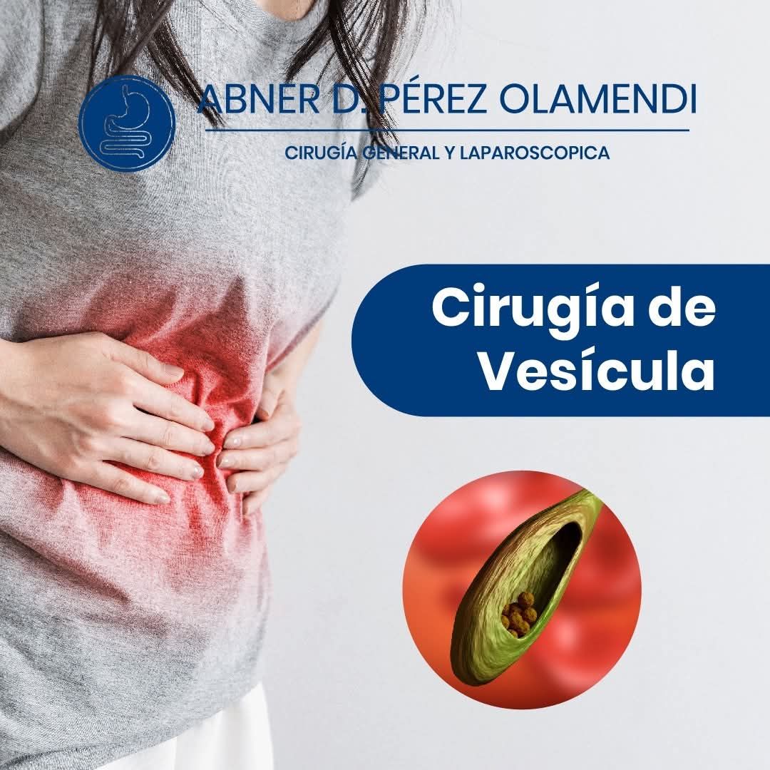 Abner Daniel Pérez Olamendi-7