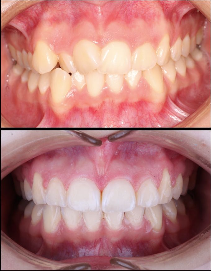 José Luis Pérez Vázquez-2