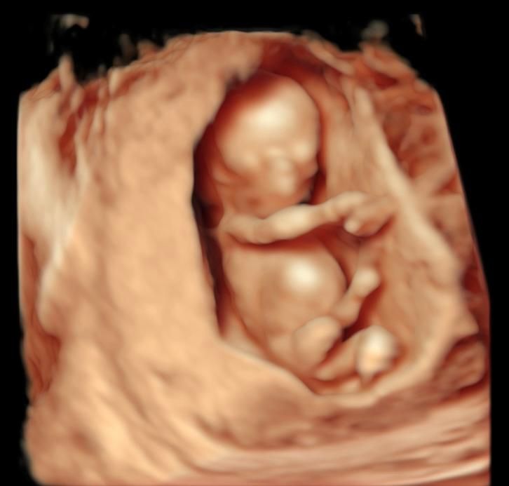 Juan Carlos De León-8