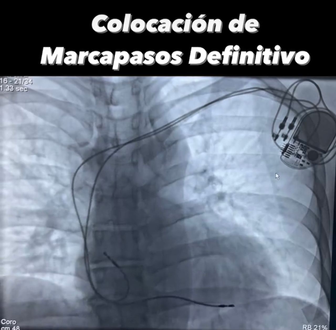 Abdón Ávila Chávez-39