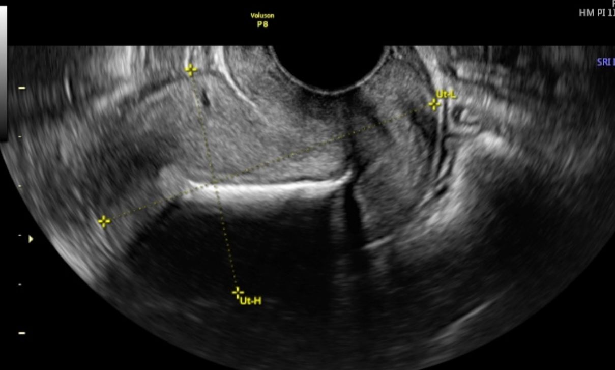 Zabdy Shirel H. Lascurain-12