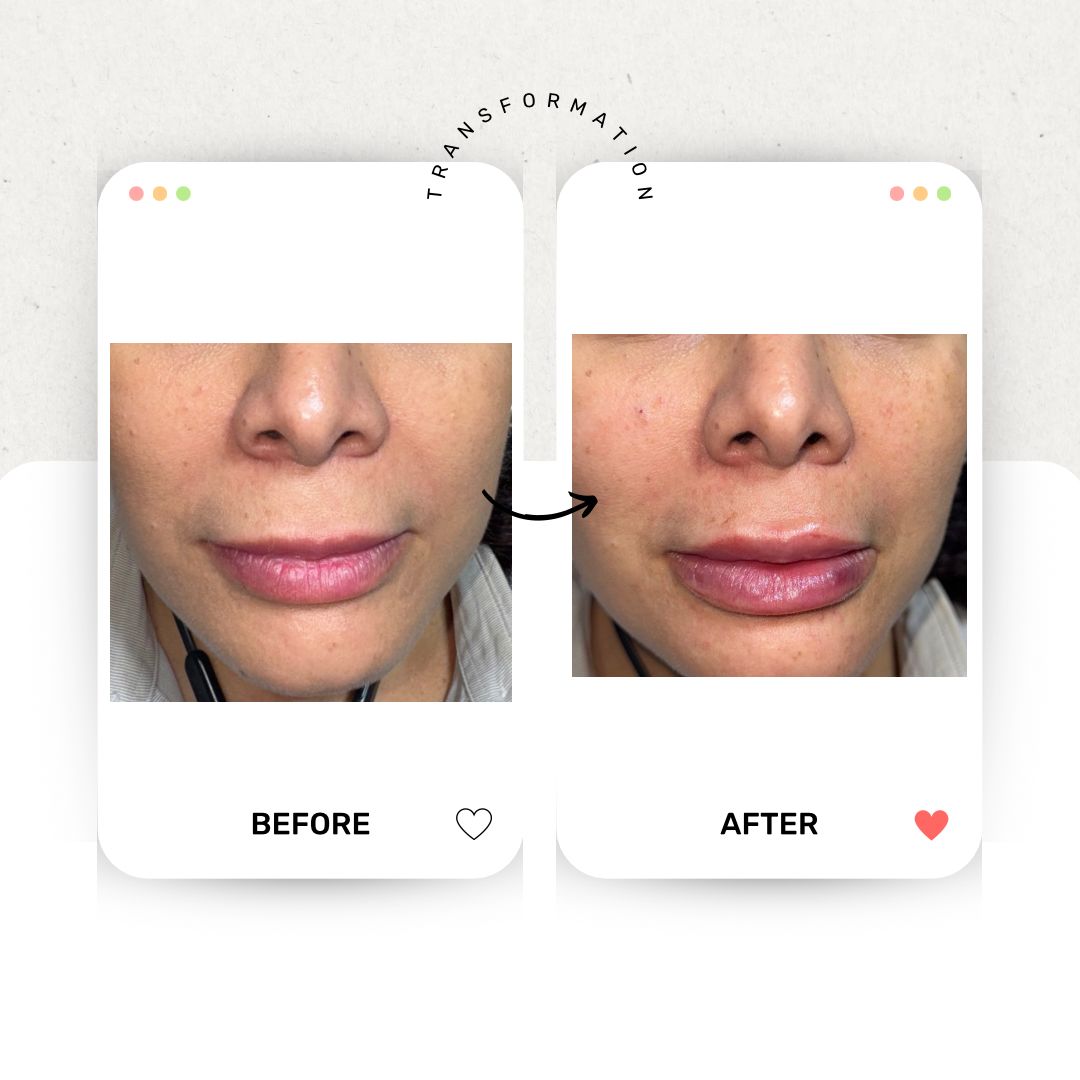 Carlos Alberto Magaña Bustamante-55