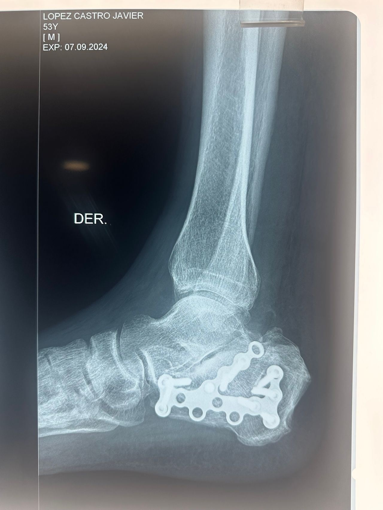 José Miguel Montiel Rojas-11