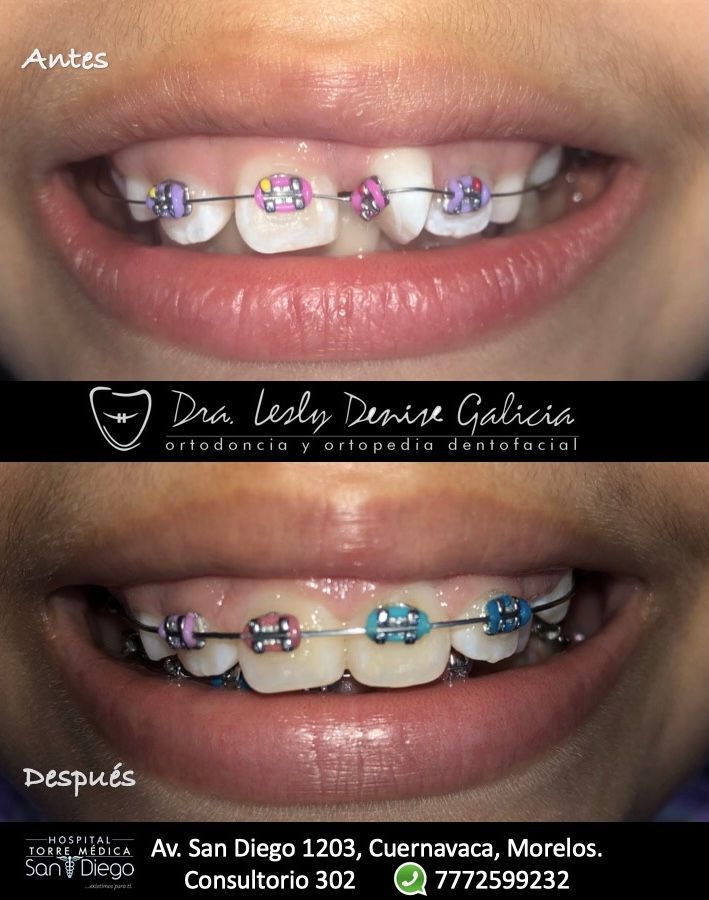 Lesly Denise Galicia Borjas-0