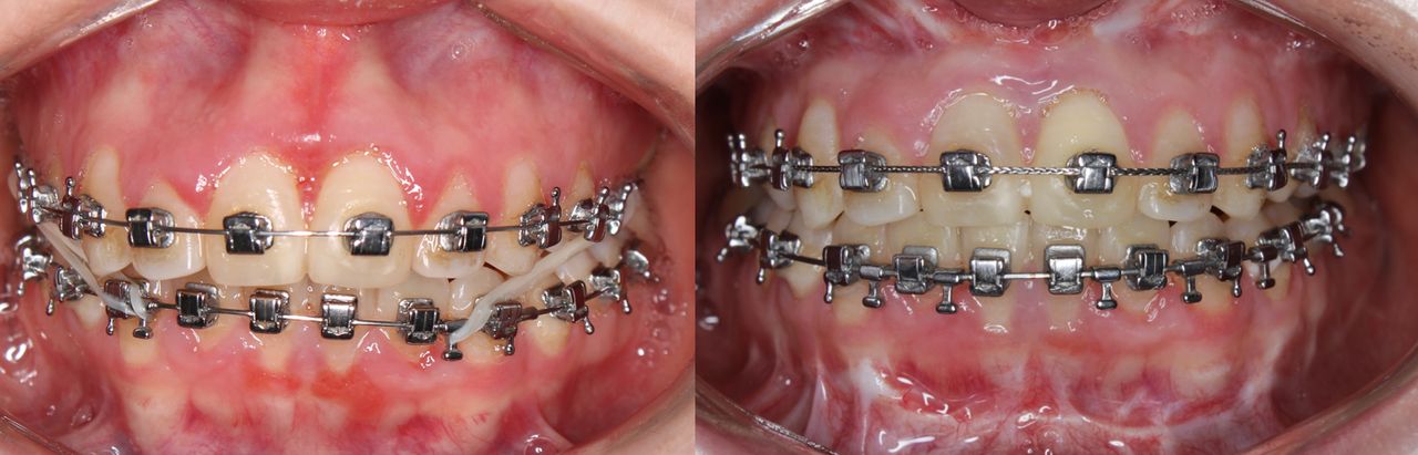 Diego Alan Cardiel Caraveo-10