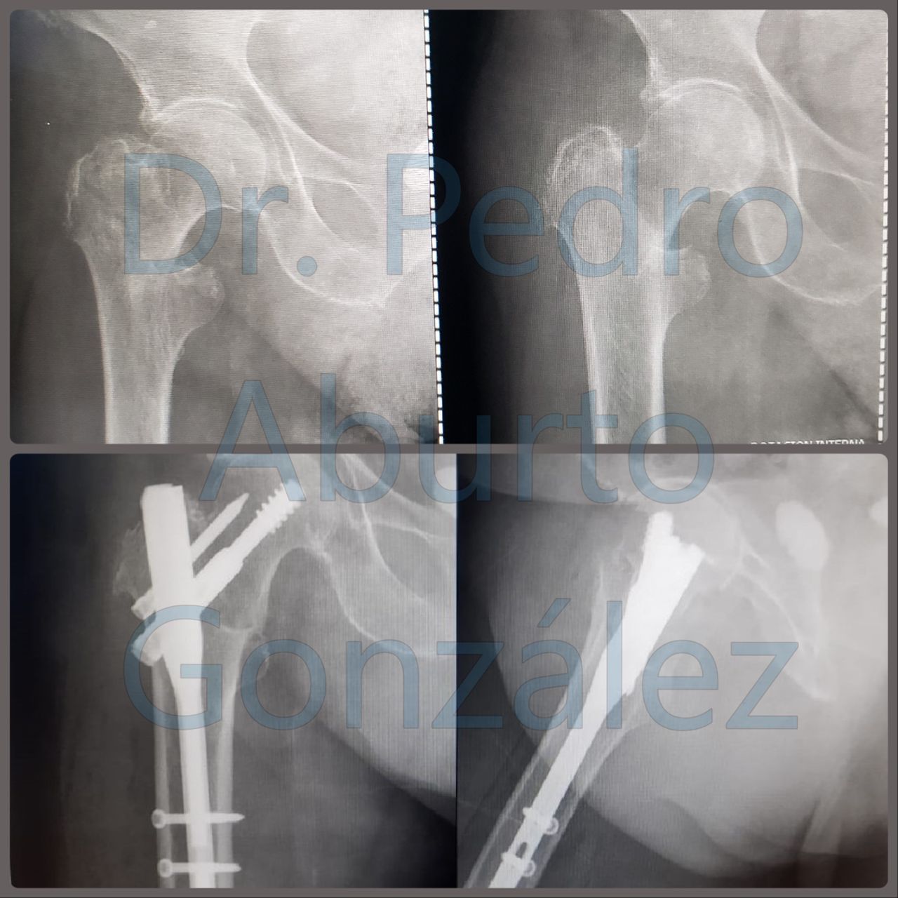 Pedro Aburto González-7