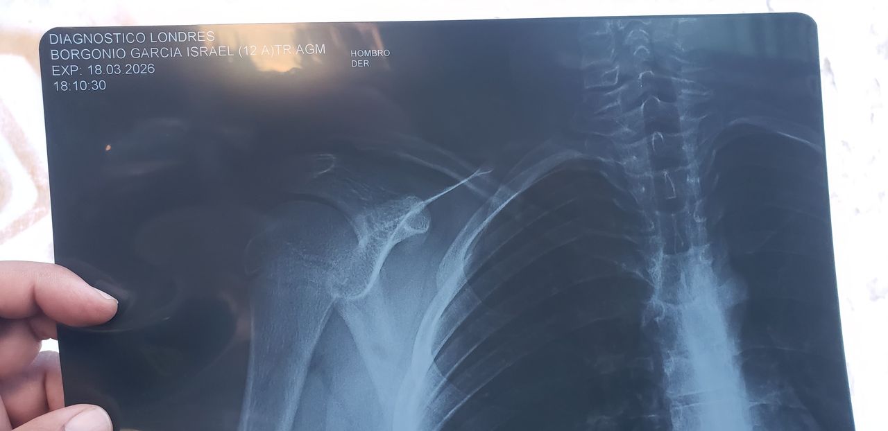 Alejandro Irisson-36