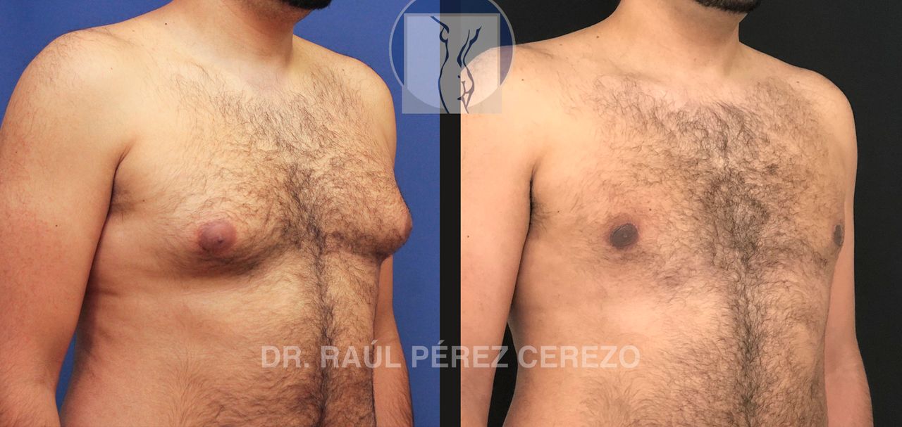 Raúl Pérez Cerezo-36