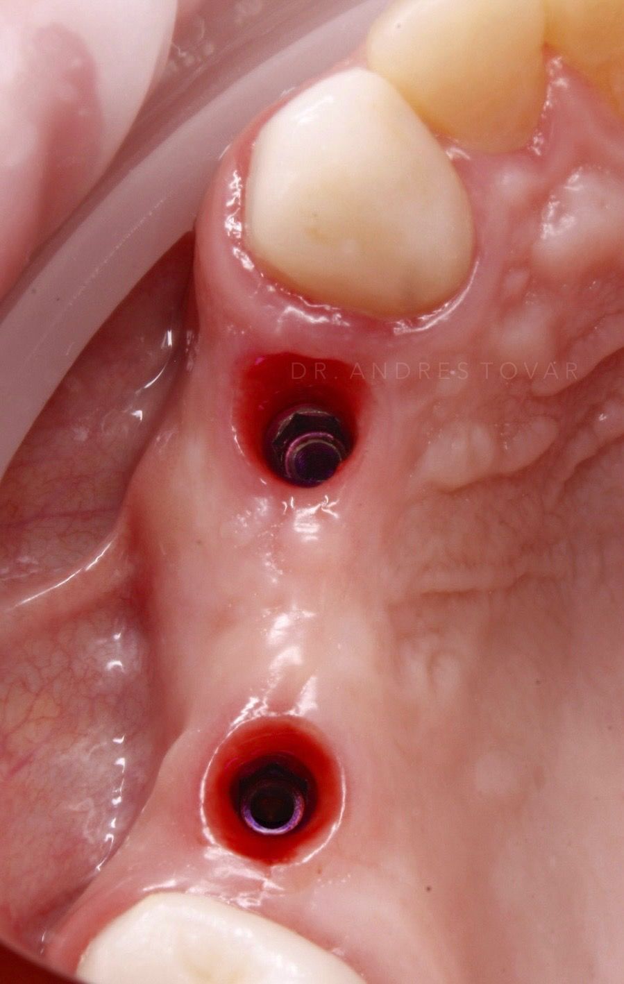 Andrés Tovar López-21