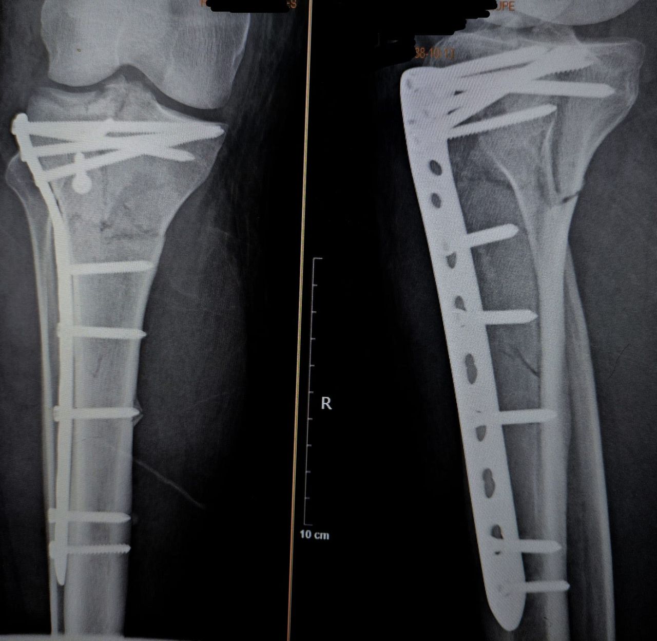 Luis Angel Moreno Espinoza-11