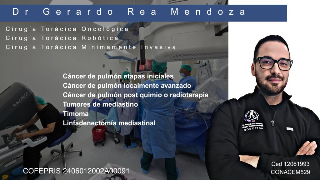 Gerardo Rea Mendoza-8