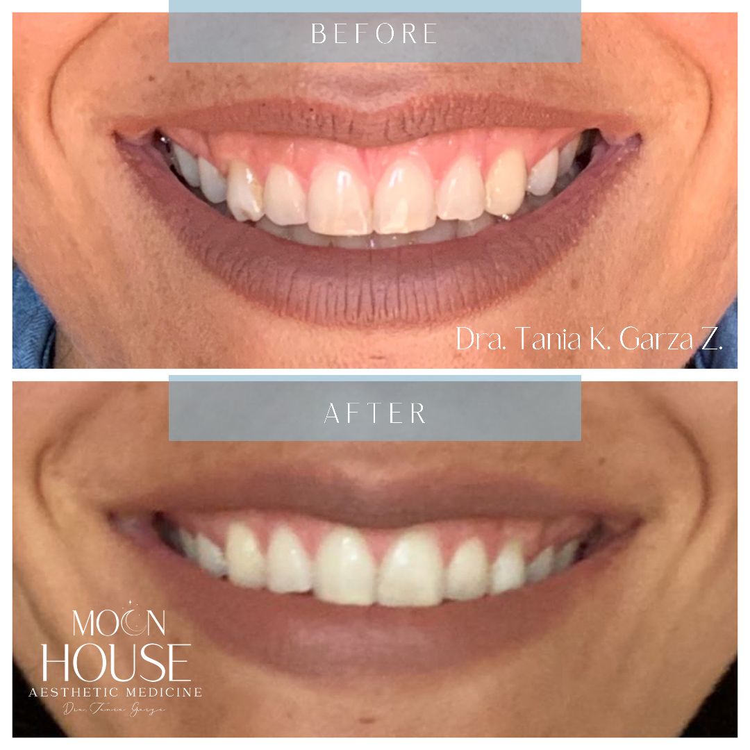 Tania Karine Garza Zepeda-9