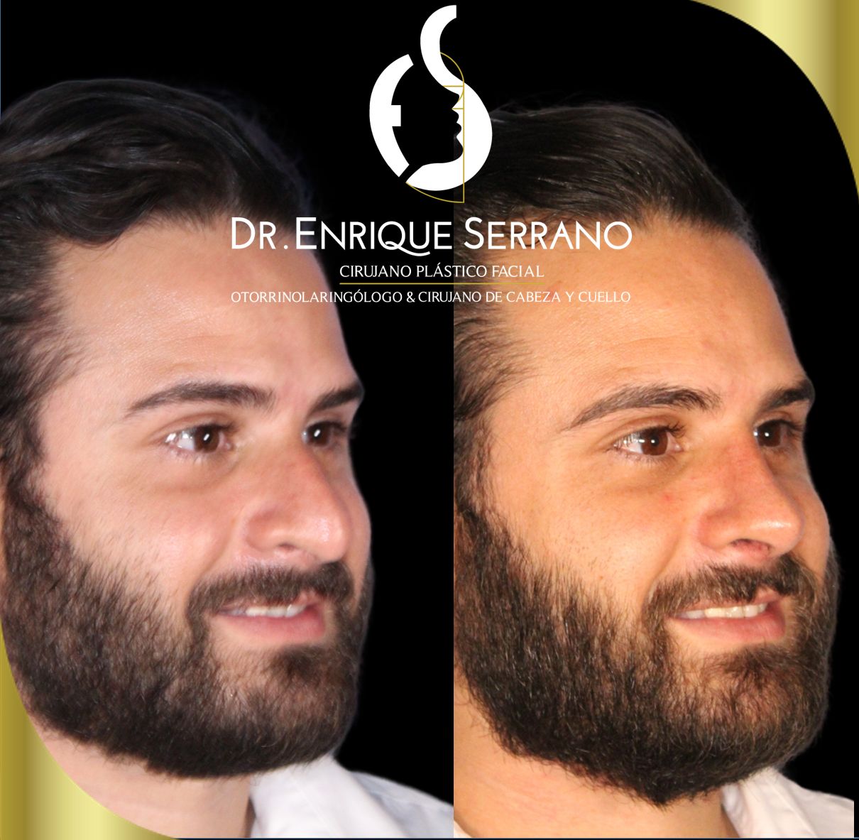 Enrique Serrano Cruz-1