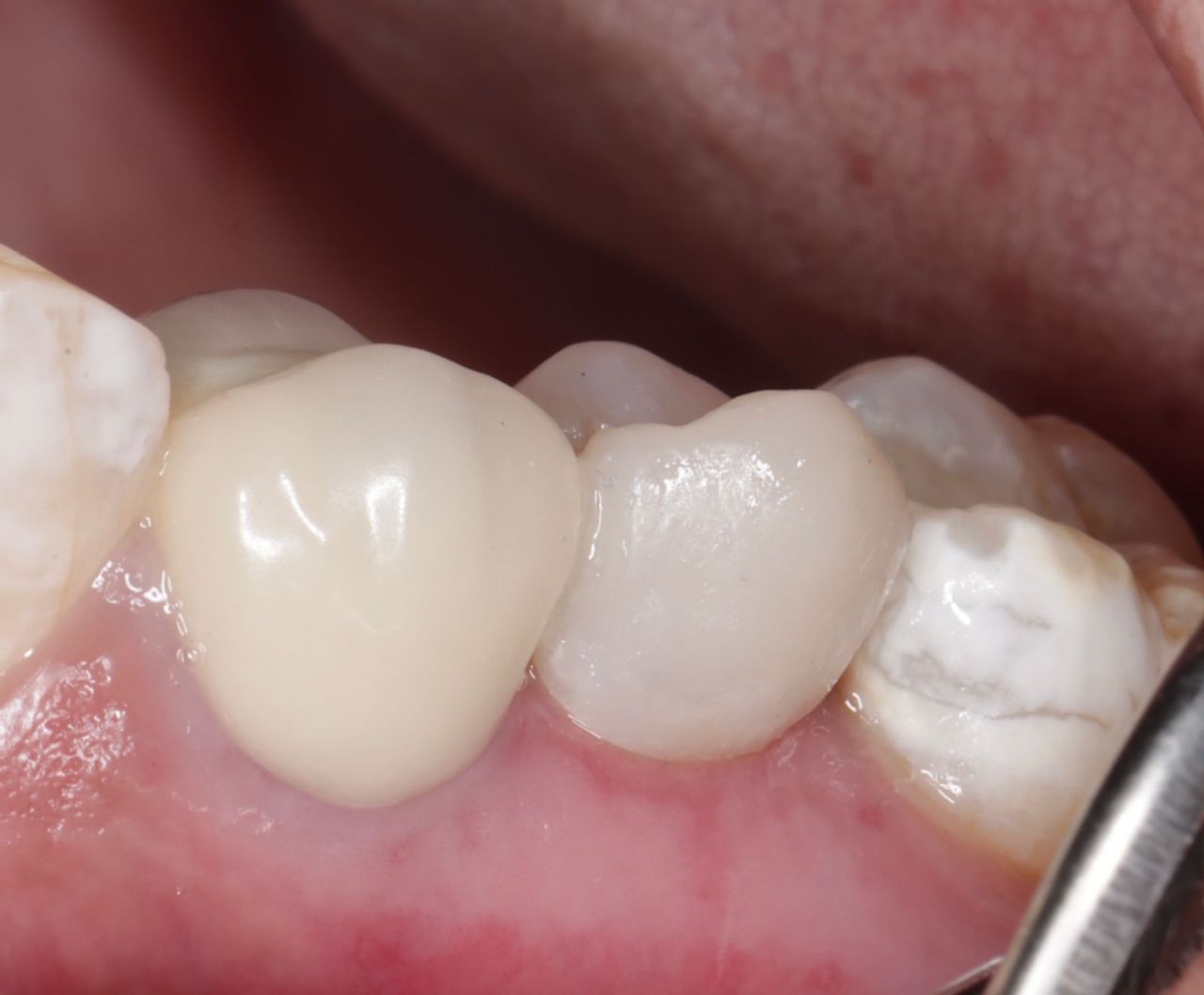 Fredy Alejandro Roblero Gónzalez-28