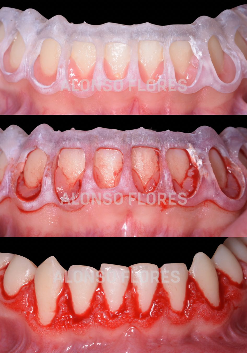 Luis Alonso Flores Reyna-2