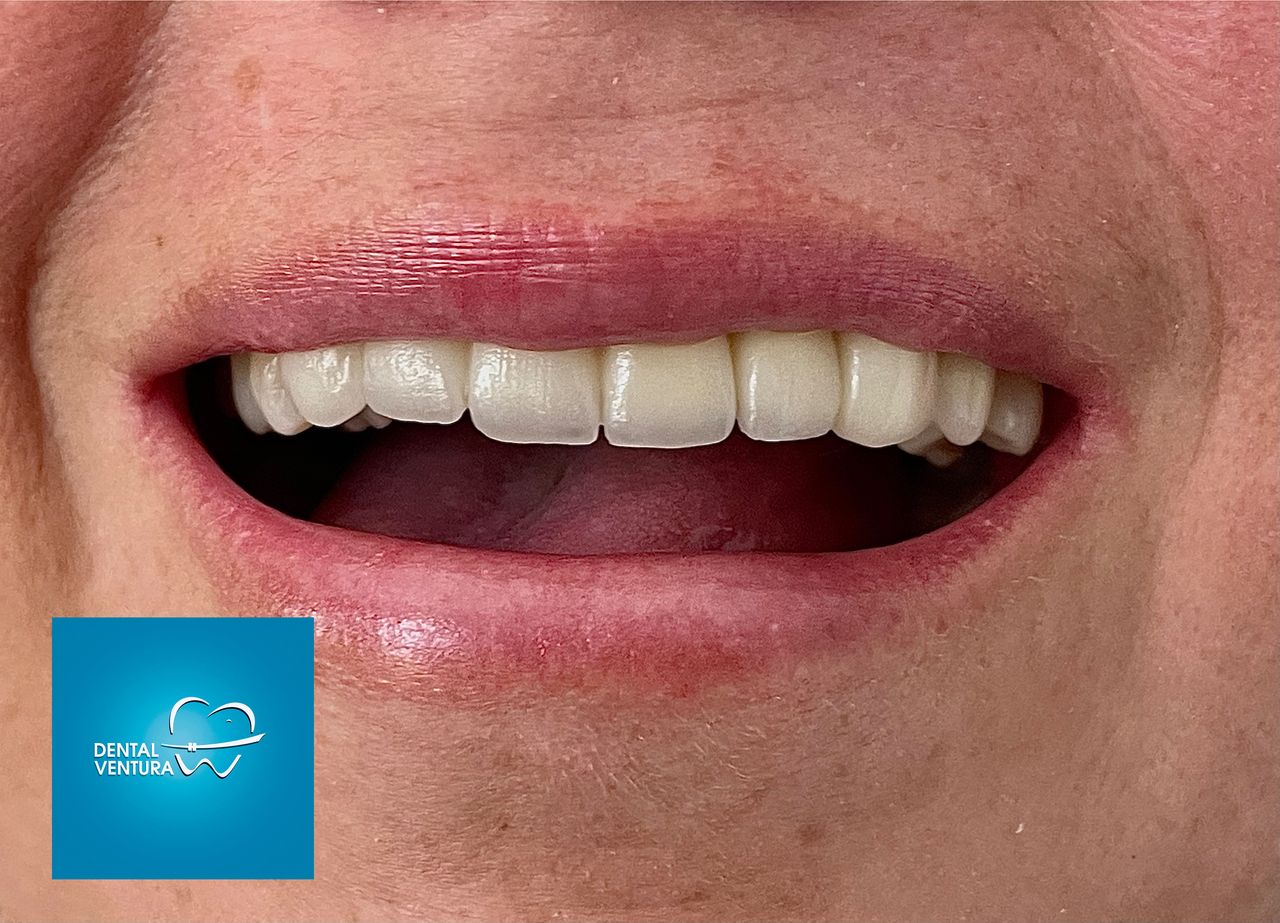 Antonio Cerda Ventura-4