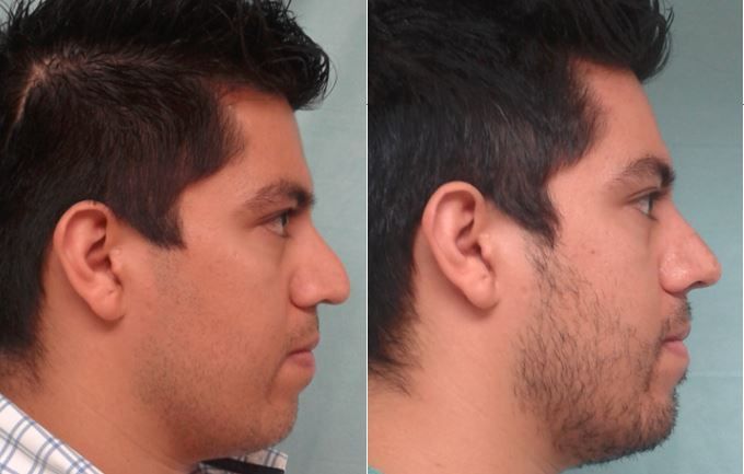 Marisol Ceja Zepeda-40