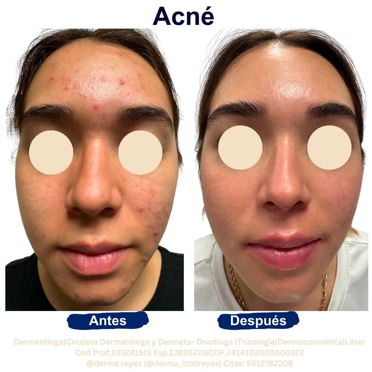 Itzel Anayn Flores Reyes-7