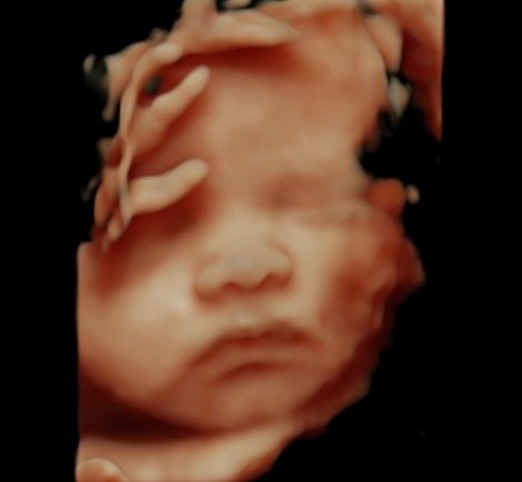 Zabdy Shirel H. Lascurain-5