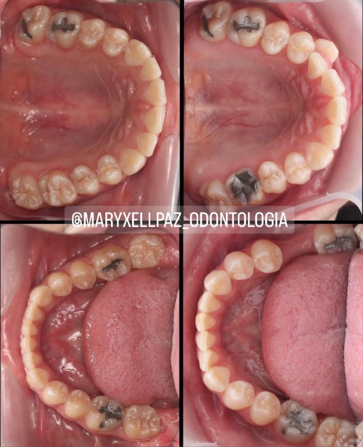 Maryxell Paz González-12