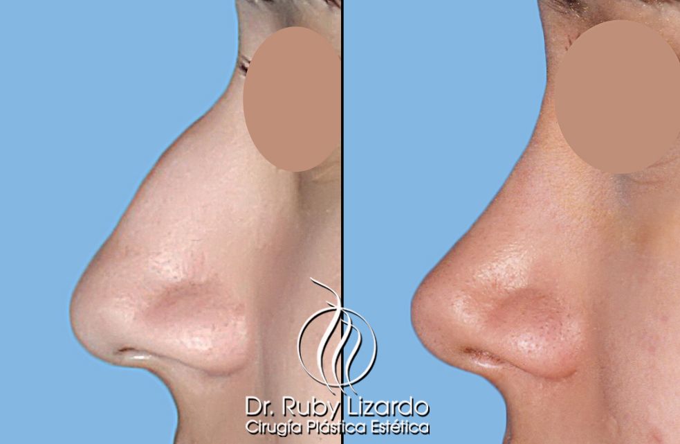 Ruby Lizardo Ramírez Robles-27