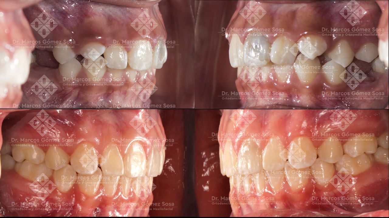 Marcos Gómez Sosa-9