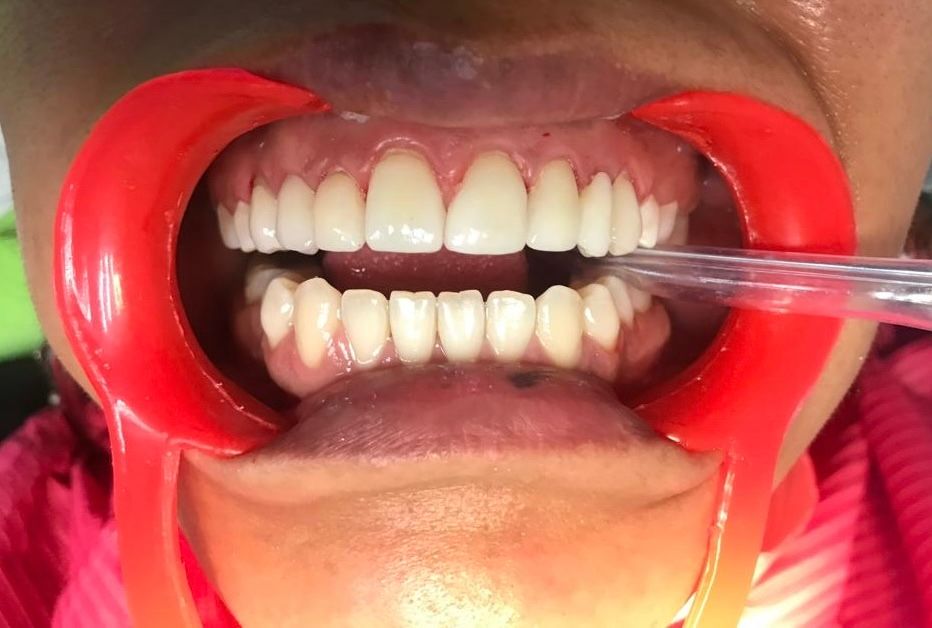 Martha Grissel Alcantar Camacho-12