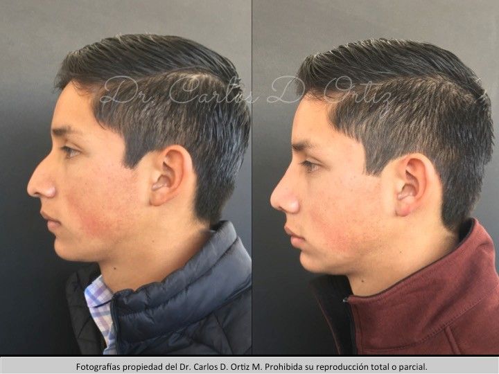 Carlos David Ortiz Moreno-32