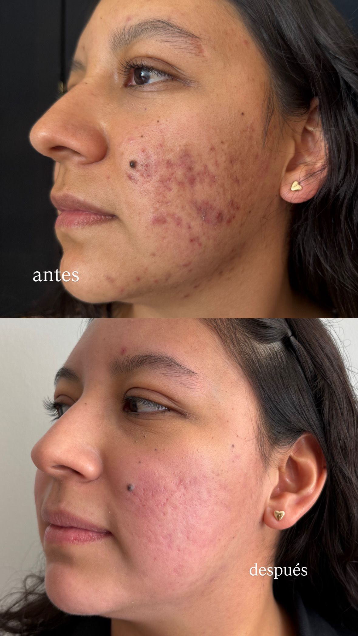 Venecia Landini Enríquez-11