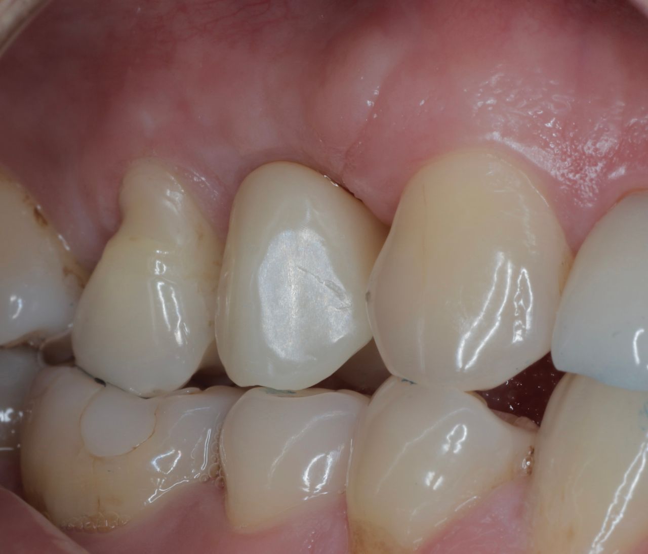 Marco Tulio Alzaga Vega-6