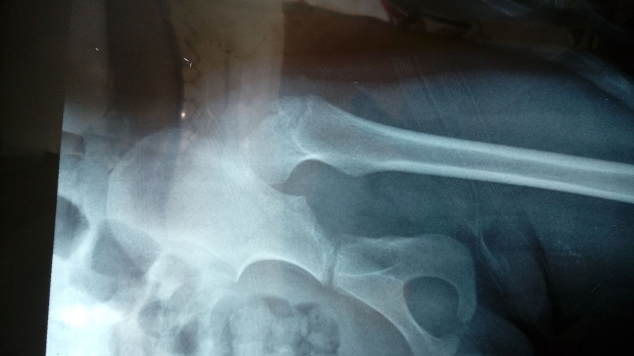 Valerio Licerio De La Cruz-4