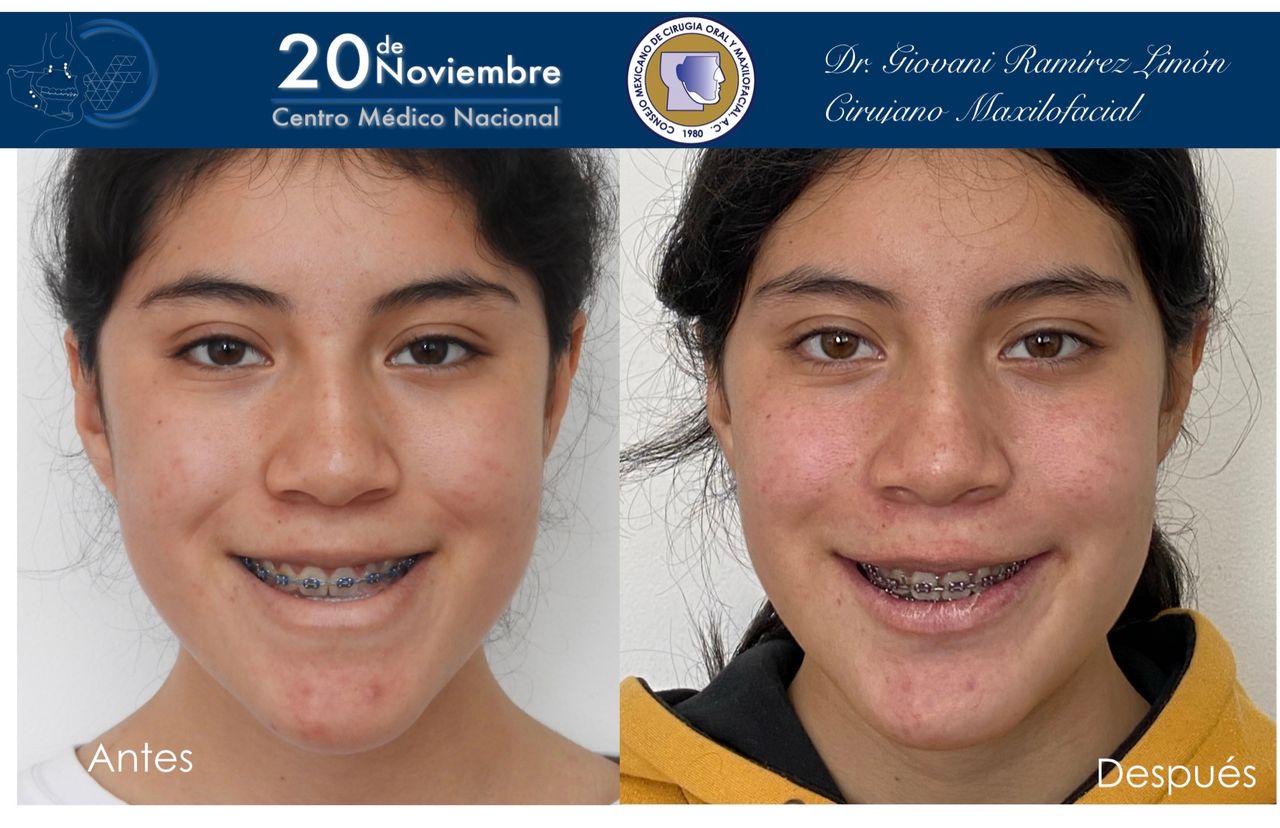 Giovani Ramírez Limón-27