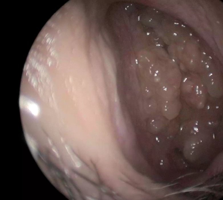 Edgar Paul Salas Lira-1