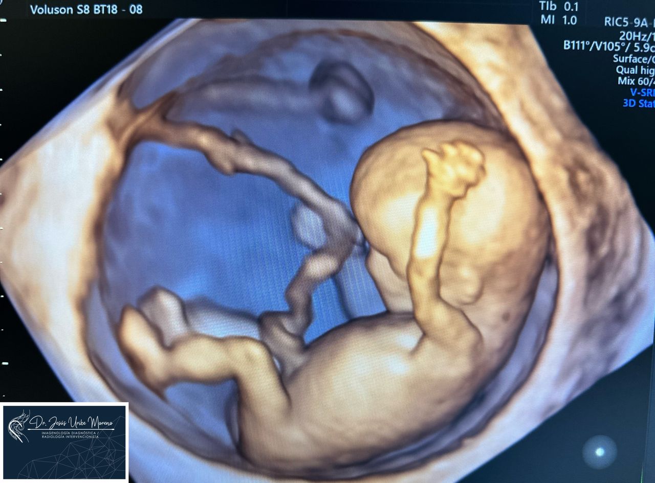 Jesus Uribe Moreno-7