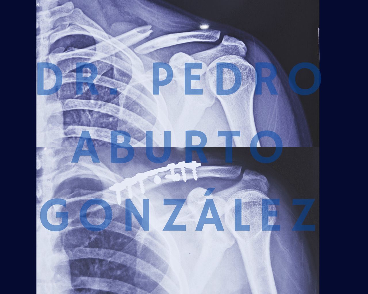 Pedro Aburto González-2