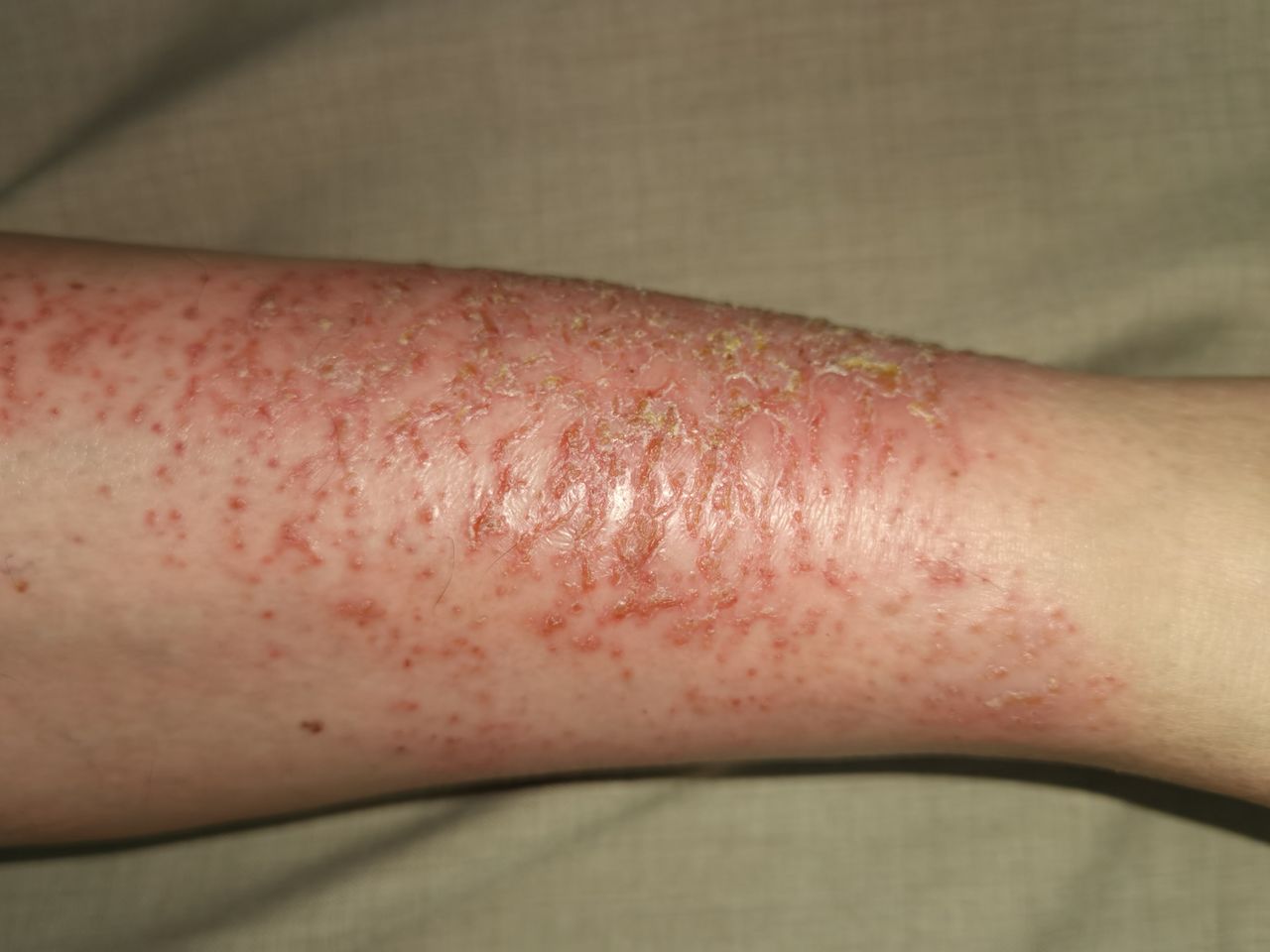 Lauro Francisco Varela Coronado-10