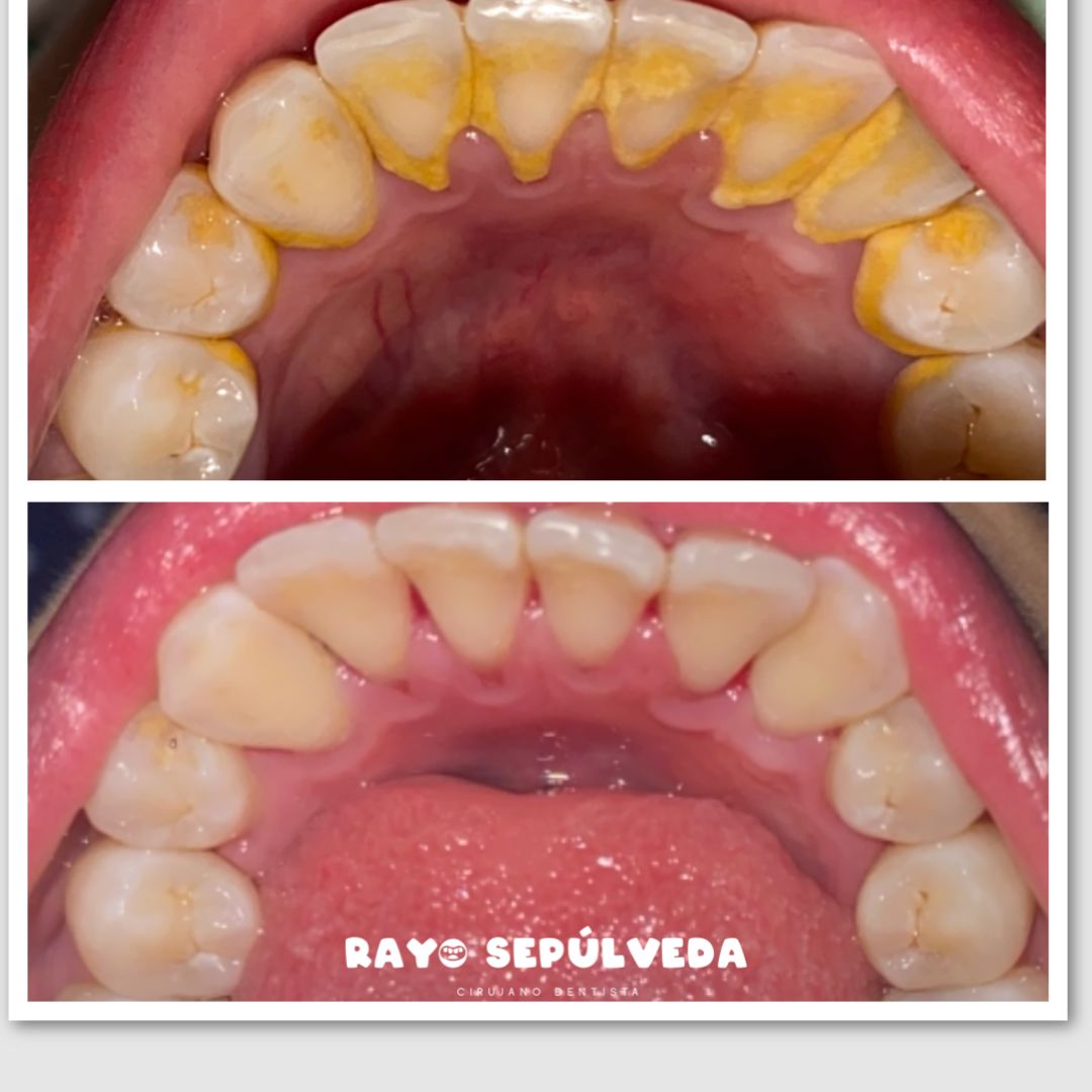 Rayo Sepulveda López-2