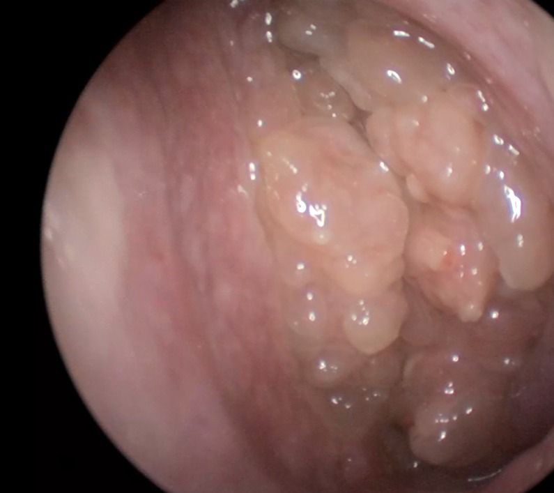 Edgar Paul Salas Lira-0