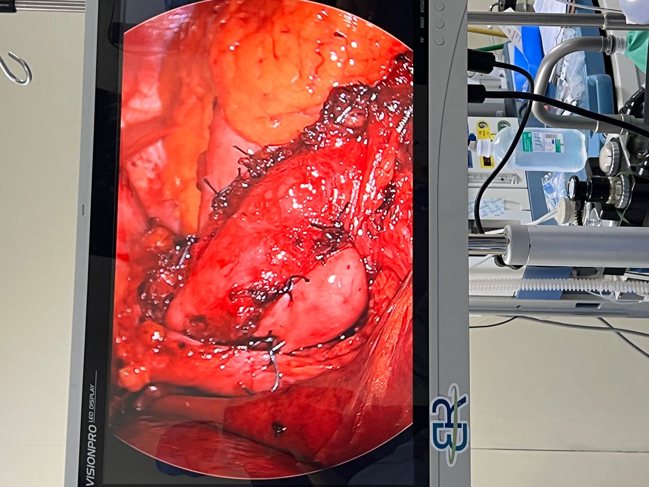 Manuel Alejandro Meza Jasso-4