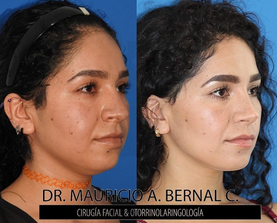 Mauricio Alejandro Bernal Carreon-4