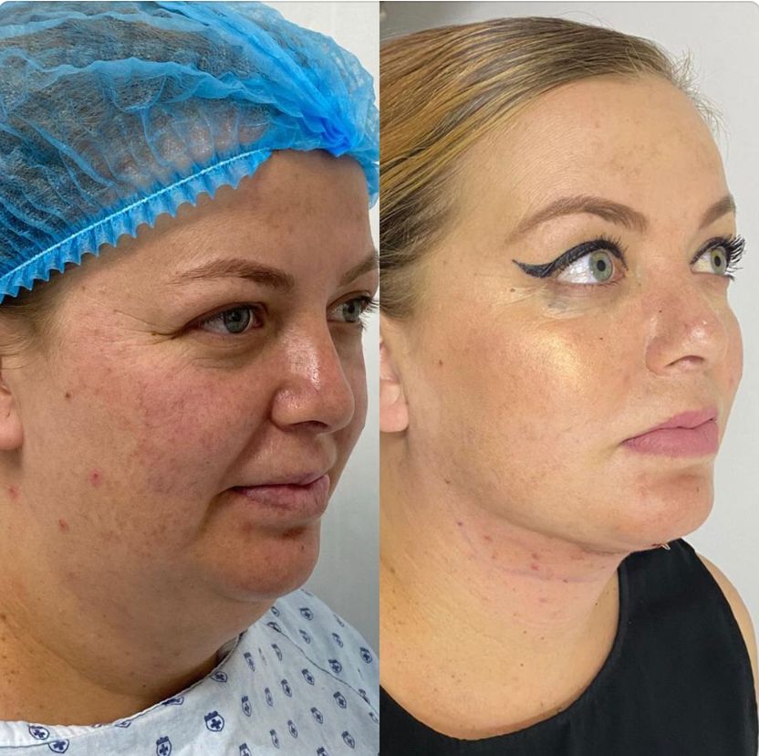 Elsa Sánchez Robles-19